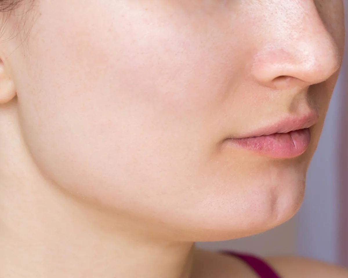 Before - Skin with concerns